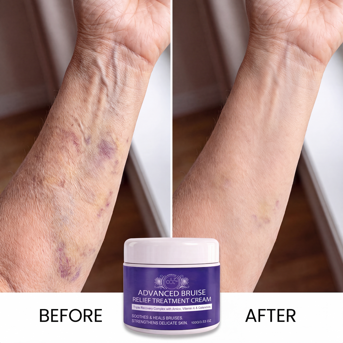 Advanced Bruise Relief Cream
