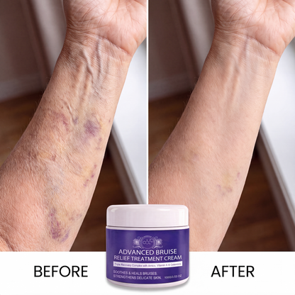 Advanced Bruise Relief Cream